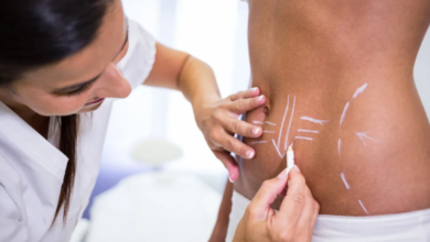 What Can a Tummy Tuck in Dubai Do for You?